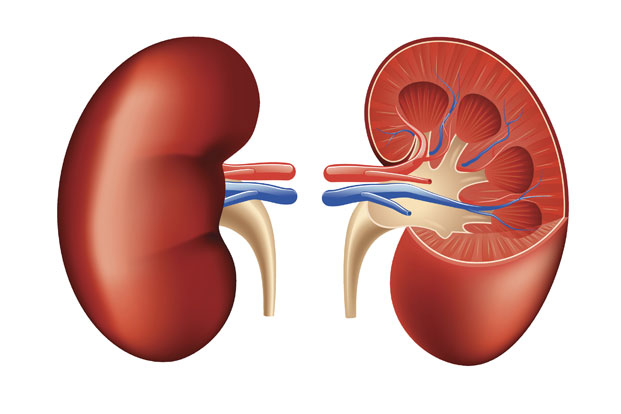 Symptoms of Kidney Stones