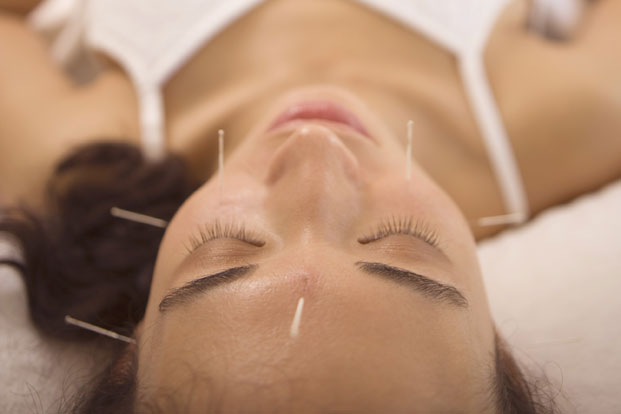 3 Ways to Get Acupuncture for Less