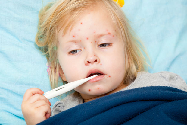 6 of the Most Highly Contagious Diseases