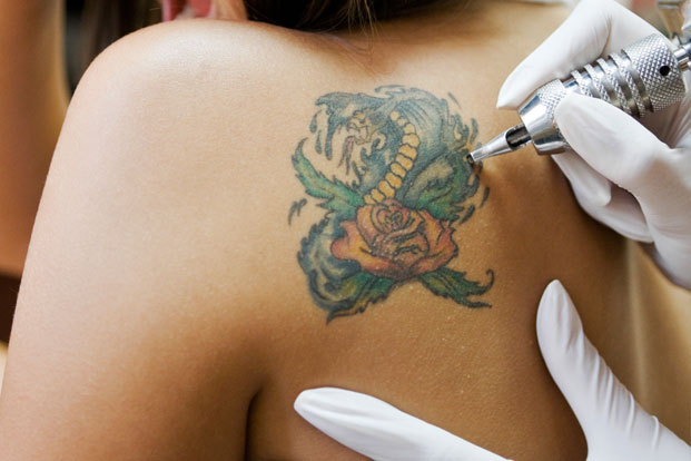 Permanent Problems: When Tattoos Go Wrong…and How it Gets Ugly Fast)