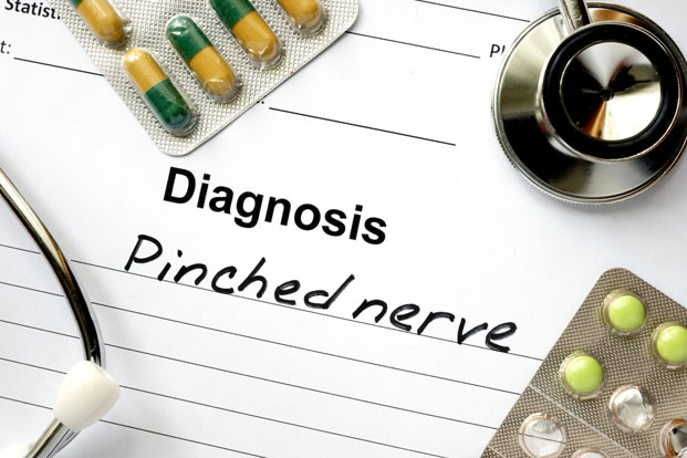 5 Ways to Contend with a Pinched Nerve